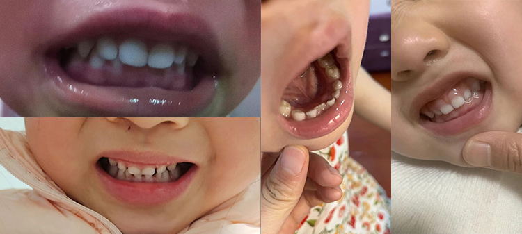 new user that stands to benefit from teeth cleaning kit is children