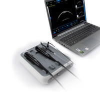 Сканер ABP SW-21 с UBM 4 в 1, Китай офтальмологический сканирование B Сканирование и сканер Pachymeter UBM
