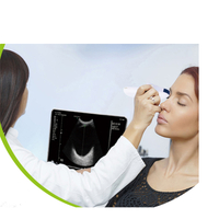 Scanner ophtalmique portable B, type sonde sans fil, doppler couleur