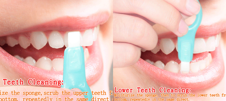the correct technique is to wipe up and down when using teeth cleaning kit