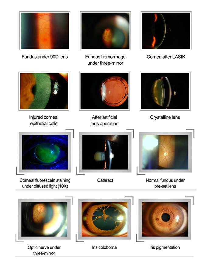 LS-5 Digital Slit Lamp for Ophthalmology