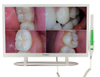 21.5 Inch Dental Monitor All in One Unit with HD 1080P Intraoral Camera