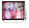 17 Inch White Monitor Dental 1080P Intraoral Camera System with Armored Glass And Holder
