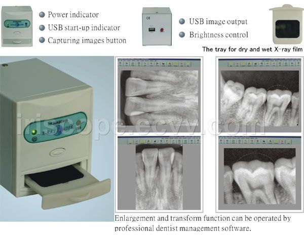 USB Dental X-ray Film Reader