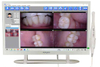 Touch Screen Computer And Intra Oral Camera 21.5inch System with Independent Graphics Card-YF2200P