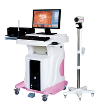 Digital Colposcope in Hospital (Model: Jy-2650)