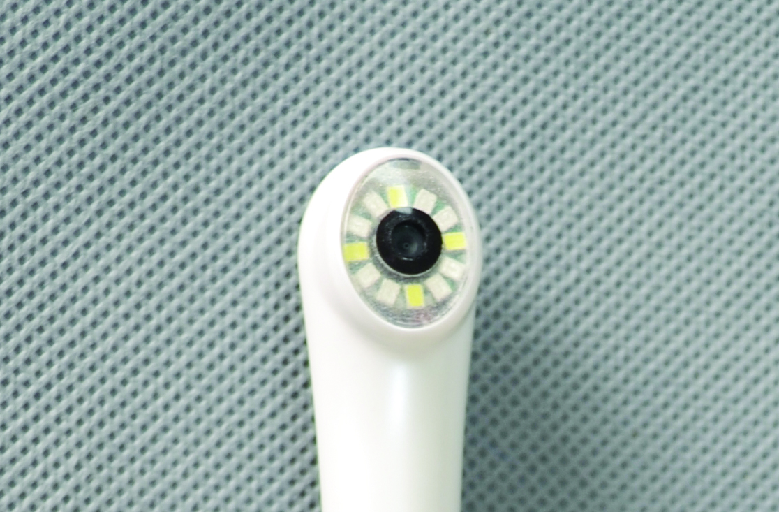1080P USB Wire Intraoral Camera with Blue & White LED