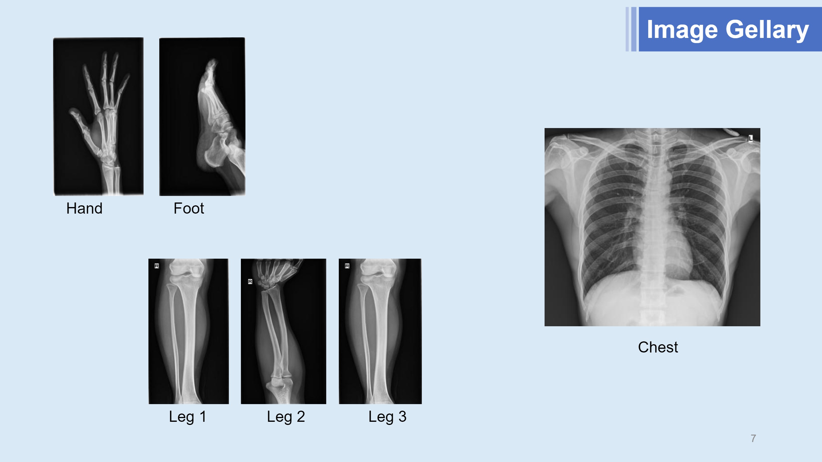LXR-160 утастай хавтгай самбар илрүүлэгч-7