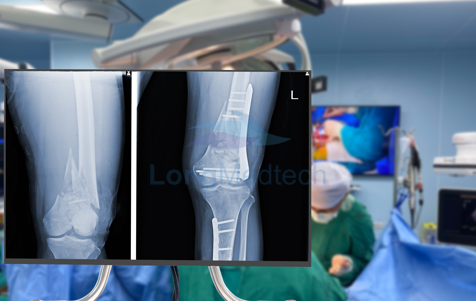 D&eacute;tecteur &agrave; &eacute;cran plat