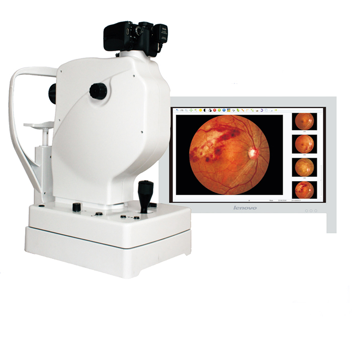 Fundus Camera-1