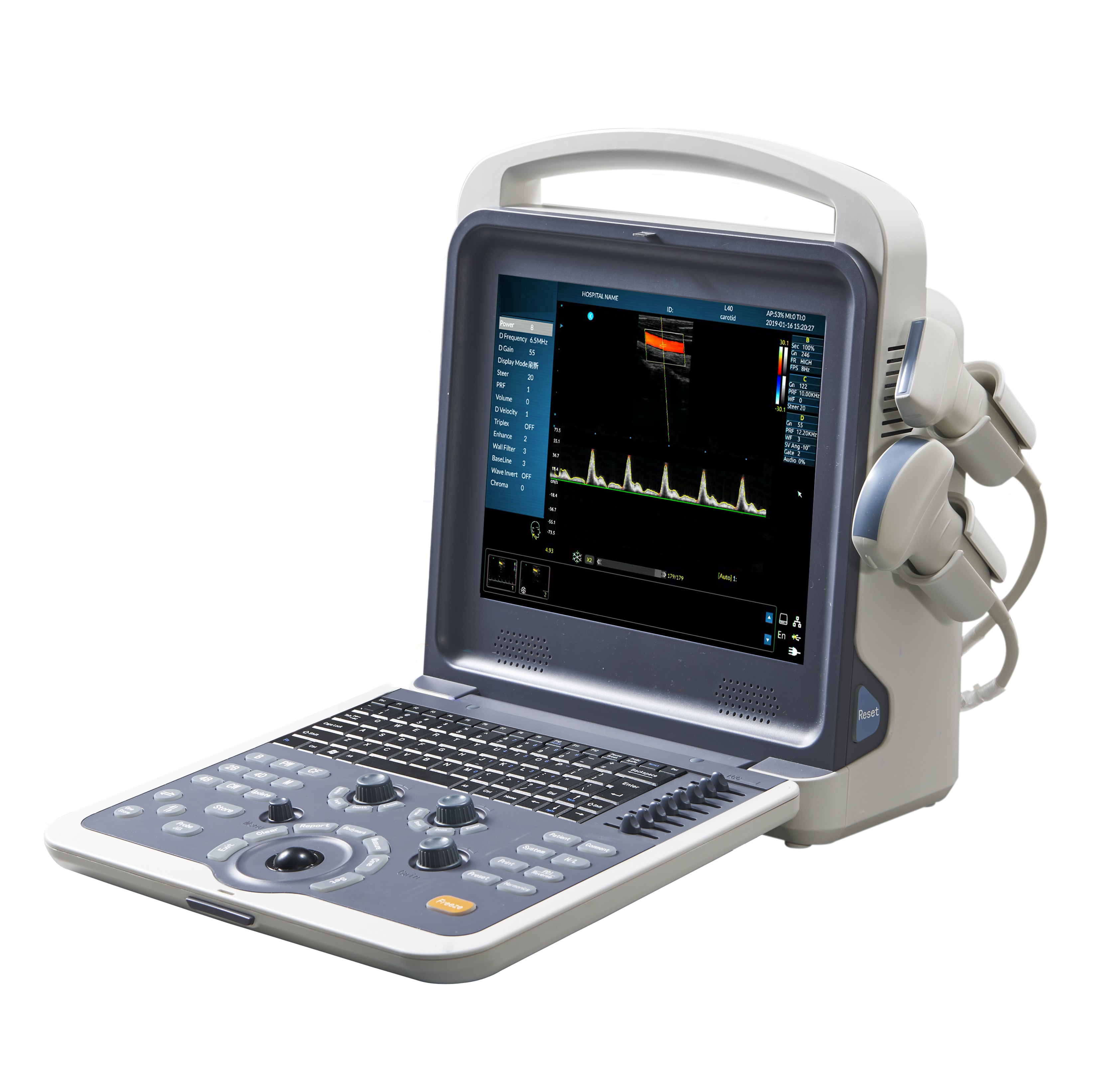 Huc 260 Medical Equipment Full Digital Portable Color Doppler
