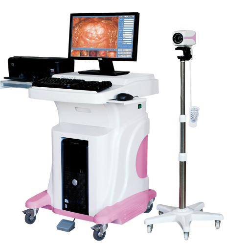 Jy-2620 Digital Video Colposcope in Hospital (model: Jy-2620)